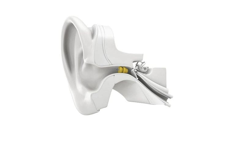 Diagram of a Lyric hearing device in an ear.